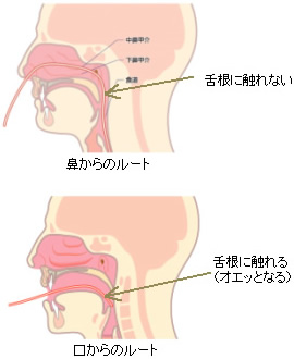 経鼻内視鏡により咽頭反射が起こらない事を表す図