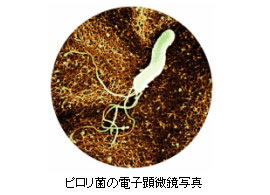 ピロリ菌の電子顕微鏡写真